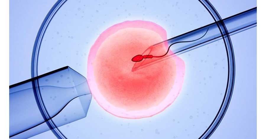 निःसन्तान दम्पती लक्षित ‘आइभिएफ’ सेवा सञ्चालन